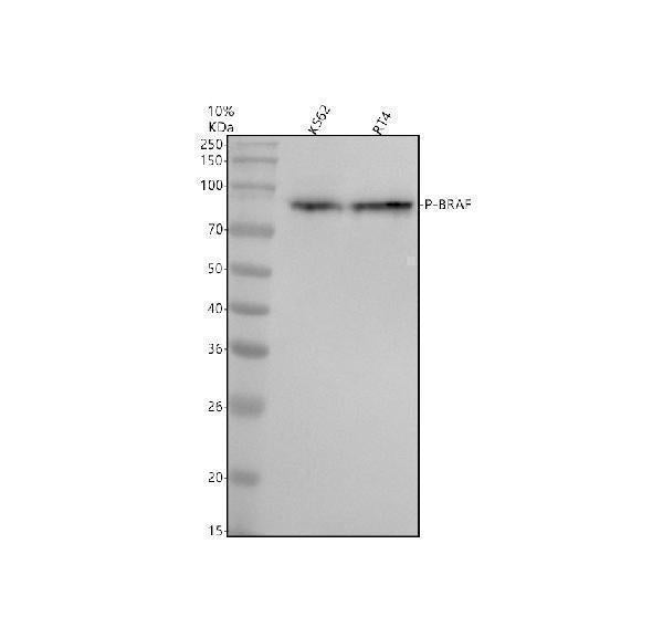 Anti-Phospho-B Raf (T401) Rabbit Monoclonal Antibody