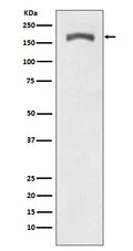 Western blot analysis of Phospho-PDGF Receptor beta (Y740) expression in NIH 3T3 treated with PDGF.