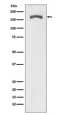 Western blot analysis of Phospho-PDGF Receptor beta (Y740) expression in NIH 3T3 treated with PDGF.