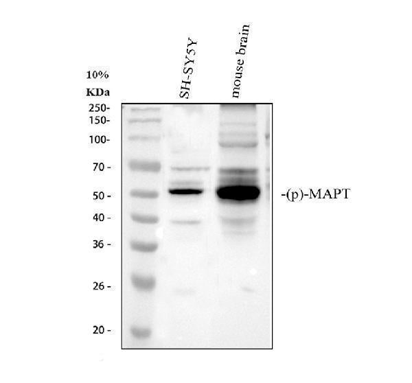 Anti-Phospho-Tau (S396) MAPT Rabbit Monoclonal Antibody