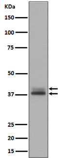 Western blot analysis of Phospho- Erk1 (T202/Y204) + Erk2 (T185/Y187) expression in A431 cell lysate treated with EGF.