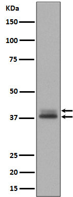 Western blot analysis of Phospho- Erk1 (T202/Y204) + Erk2 (T185/Y187) expression in A431 cell lysate treated with EGF.