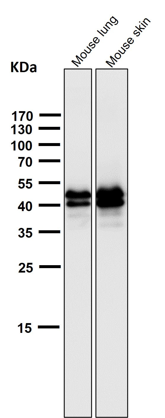 Anti-Phospho-ERK1 (T202) + ERK2 (T185) Rabbit Monoclonal Antibody