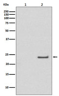 Western blot analysis of Phospho-Rac1/Cdc42 (Ser71) expression in (1) A431 cell lysate treated with LP; (2) A431 cell lysate.