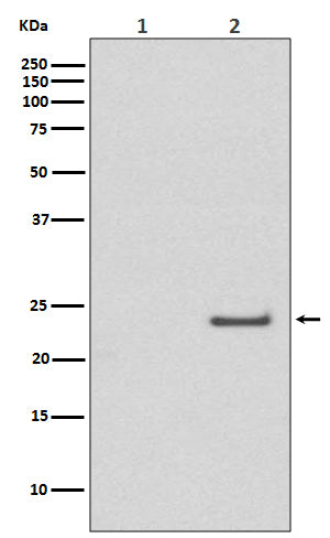 Western blot analysis of Phospho-Rac1/Cdc42 (Ser71) expression in (1) A431 cell lysate treated with LP; (2) A431 cell lysate.