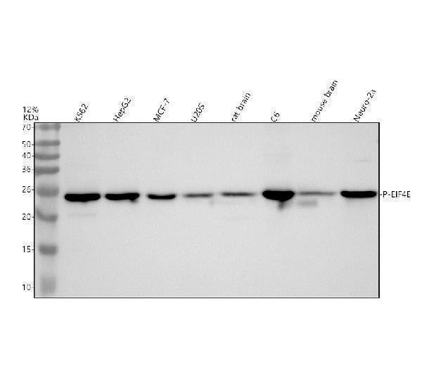 Anti-Phospho-eIF4E (S209) Rabbit Monoclonal Antibody