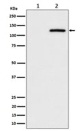 Western blot analysis of Phospho-CBL (S669) expression in (1) HeLa cell lysate; (2) HeLa cell treated with pervanadate lysate.