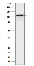 Western blot analysis of Phospho-CBL (Y774) expression in Jurkat cell treated with Pervanadate lysate.
