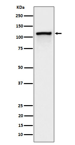 Western blot analysis of Phospho-CBL (Y774) expression in Jurkat cell treated with Pervanadate lysate.