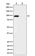 Western blot analysis of Phospho-FGFR3 (Y724) expression in (1) MCF7 treated with pervanadate cell lysate; (2) untreated.