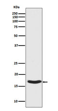 Western blot analysis of Synuclein phosphorylation expression in Human fetal brain lysate.