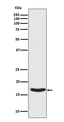 Western blot analysis of Synuclein phosphorylation expression in Human fetal brain lysate.