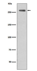 Western blot analysis of Filamin A phosphorylation expression in WT-LRRK2 cell lysate treated LRRK2.
