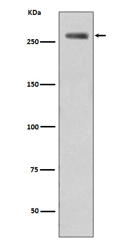Western blot analysis of Filamin A phosphorylation expression in WT-LRRK2 cell lysate treated LRRK2.