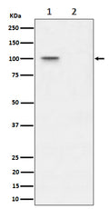 Western blot analysis of Phospho-Nucleolin (T76) expression in (1) 293T cell lysate; (2) 293T cell treated with Lambda Phosphatase lysate.