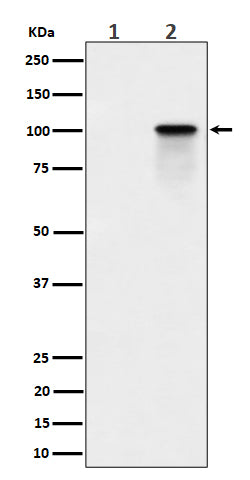 Western blot analysis of Phospho-Nucleolin (T84) expression in (1) K562 cell lysate; (2) K562 cell treated with Calyculin A lysate.