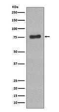Western blot analysis of Phospho-BTK (Y223) expression in Raji cell lysate treated with pervanadate.