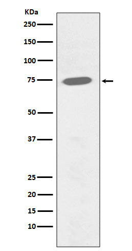Western blot analysis of Phospho-BTK (Y551) expression in Ramos cell lysate treated with Pervanadate.