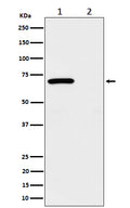 Western blot analysis of Phospho-Chk2 (T68) expression in (1) 293 treated with UV and Untreated cell lysate; (2) Untreated.