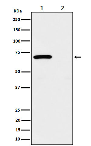 Western blot analysis of Phospho-Chk2 (T68) expression in (1) 293 treated with UV and Untreated cell lysate; (2) Untreated.