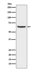 Western blot analysis of Phospho-NF-κB p65 (S529) expression in HeLa cell lysates treated with Calyculin A and TNF-alpha.
