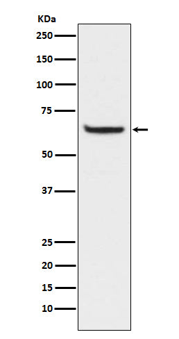 Western blot analysis of Phospho-NF-κB p65 (S529) expression in HeLa cell lysates treated with Calyculin A and TNF-alpha.