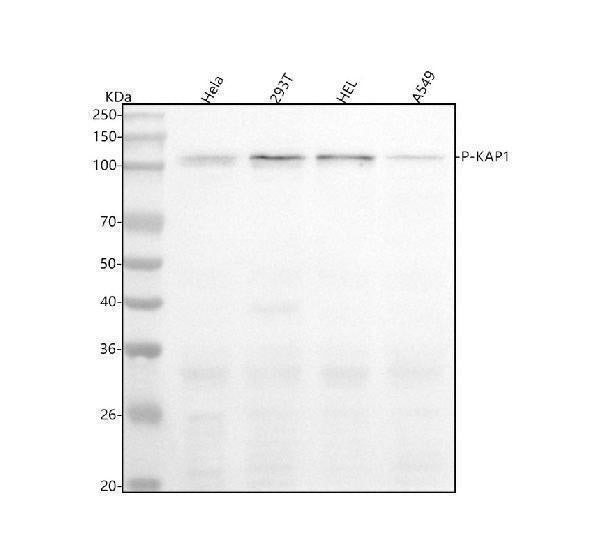 Anti-Phospho-KAP1 (S824) Rabbit Monoclonal Antibody