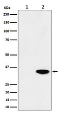 Western blot analysis of Phospho-Nucleophosmin (T199) expression in (1) HeLa cell lysate; (2) HeLa cell treated with CA lysate.