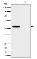 Western blot analysis of Phospho-MLKL (S345) expression in (1) L929 treated with Z-VAD + TNF alpha + SM164 cell lysate; (2) Untreated.