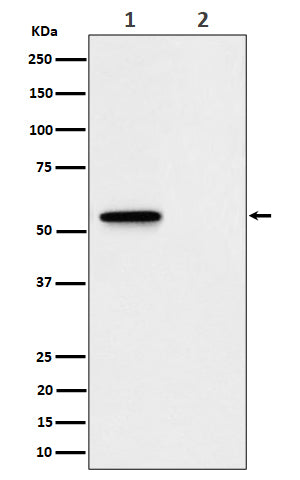 Western blot analysis of Phospho-MLKL (S345) expression in (1) L929 treated with Z-VAD + TNF alpha + SM164 cell lysate; (2) Untreated.