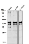 All lanes use the Antibody at 1:1k dilution for 1 hour at room temperature.