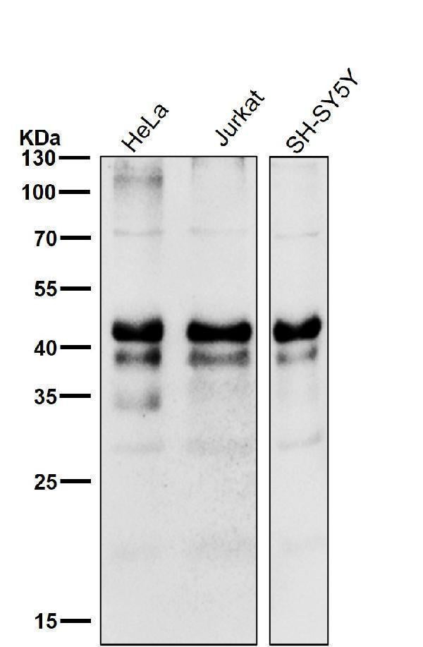 All lanes use the Antibody at 1:1k dilution for 1 hour at room temperature.