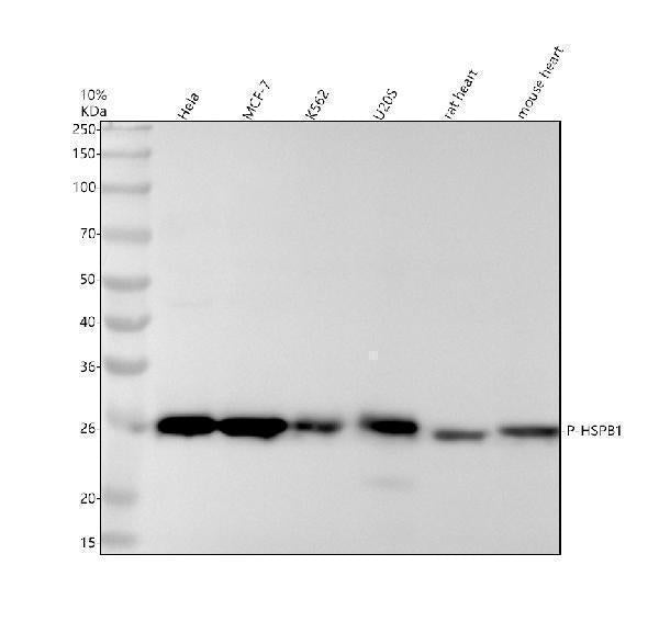 Anti-Phospho-Hsp27 (S82) HSPB1 Rabbit Monoclonal Antibody