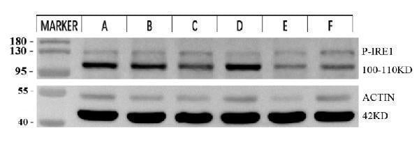 Anti-Phospho-IRE1 (S724) ERN1 Rabbit Monoclonal Antibody