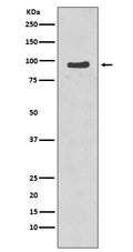 Western blot analysis of p95/NBS1 phosphorylation expression in Jurkat cell lysate treated with Etopside.