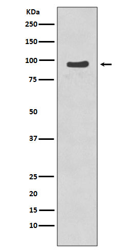 Western blot analysis of p95/NBS1 phosphorylation expression in Jurkat cell lysate treated with Etopside.
