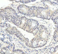 Anti-Phospho-PKC alpha (T638) PRKCA Rabbit Monoclonal Antibody