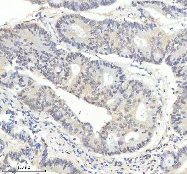Anti-Phospho-PKC alpha (T638) PRKCA Rabbit Monoclonal Antibody