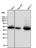 Anti-Phospho-GSK3 beta (Ser9) Rabbit Monoclonal Antibody