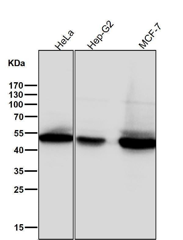 Anti-Phospho-GSK3 beta (Ser9) Rabbit Monoclonal Antibody