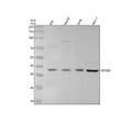 Anti-Phospho-IKB alpha (S36) Rabbit Monoclonal Antibody