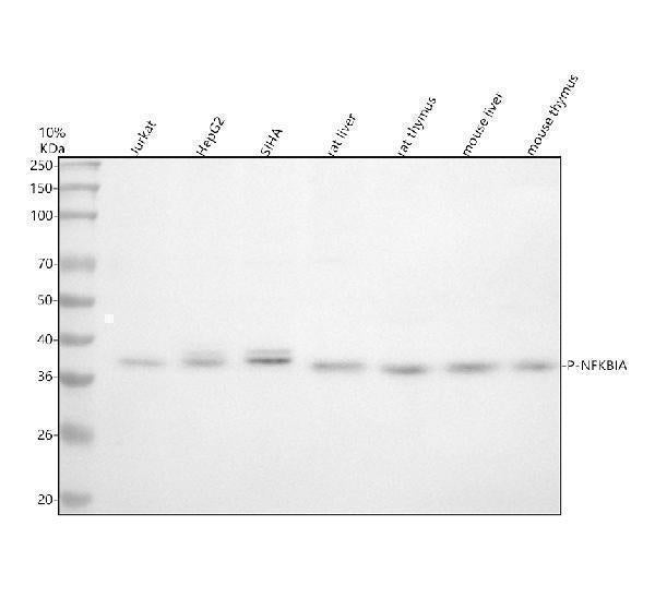 Anti-Phospho-IKB alpha (S32) NFKBIA Rabbit Monoclonal Antibody