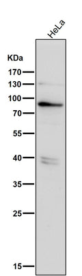 All lanes use the Antibody at 1:3K dilution for 1 hour at room temperature.