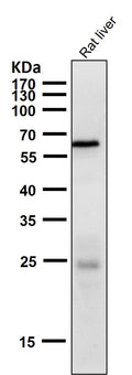 All lanes use the Antibody at 1:1K dilution for 1 hour at room temperature.