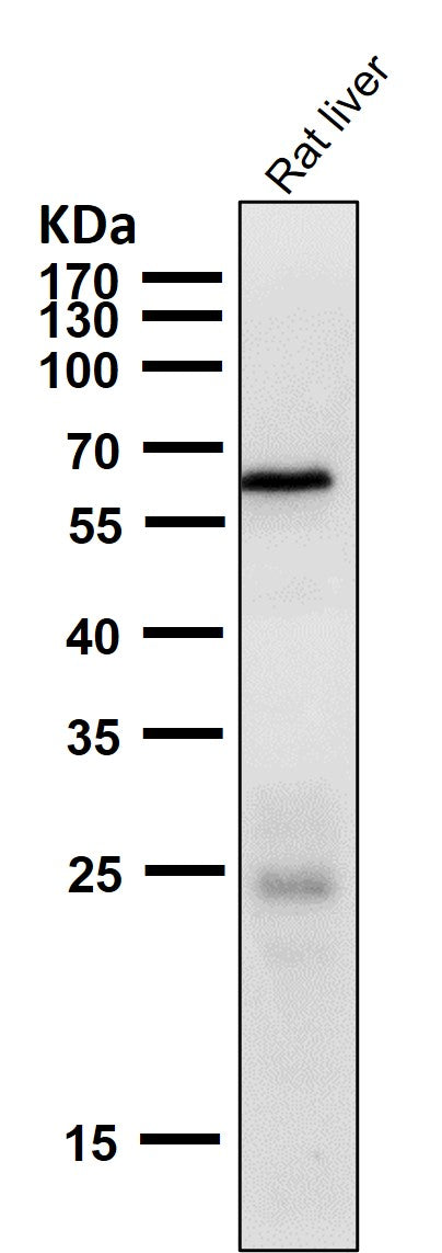 All lanes use the Antibody at 1:1K dilution for 1 hour at room temperature.