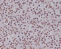 Anti-Phospho-Smad5 (S463/465) Rabbit Monoclonal Antibody