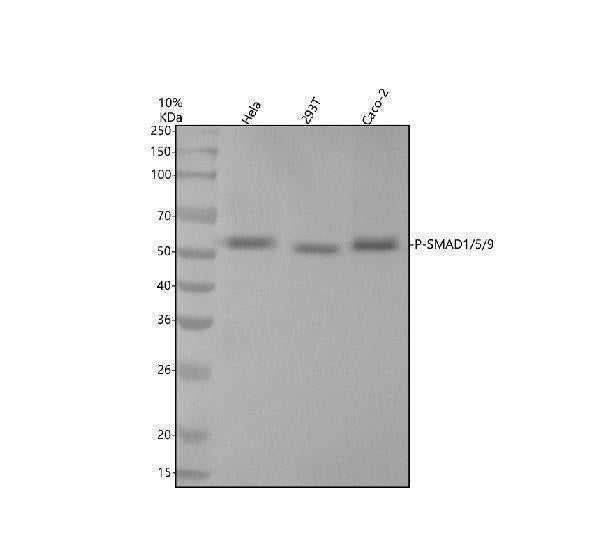 Anti-Phospho-Smad1/5/9 (S463/S465/S467) Rabbit Monoclonal Antibody