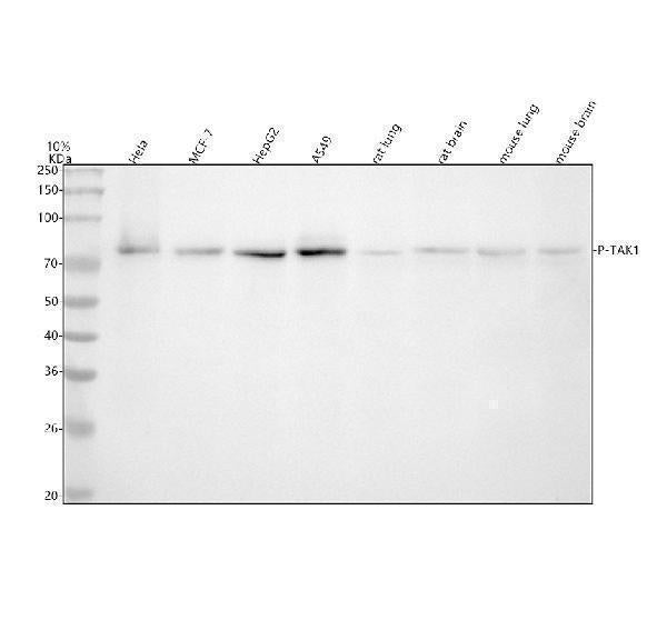 Anti-Phospho-TAK1 (S439) Rabbit Monoclonal Antibody