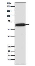Anti-Phospho-S6K1 (T421 + S424) RPS6KB1 Rabbit Monoclonal Antibody