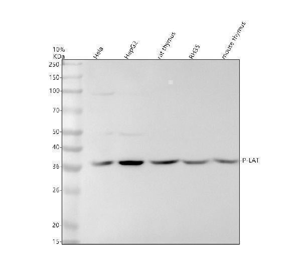 Anti-Phospho-LAT (Y191) Rabbit Monoclonal Antibody